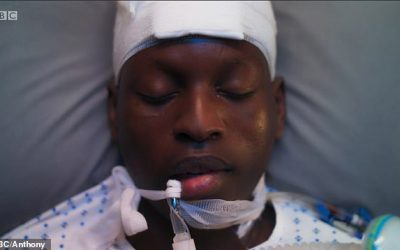 ICU props and medical advice for BBC drama Anthony