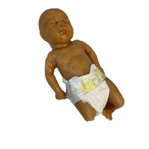 Full Term Baby - Right Leg Amputee